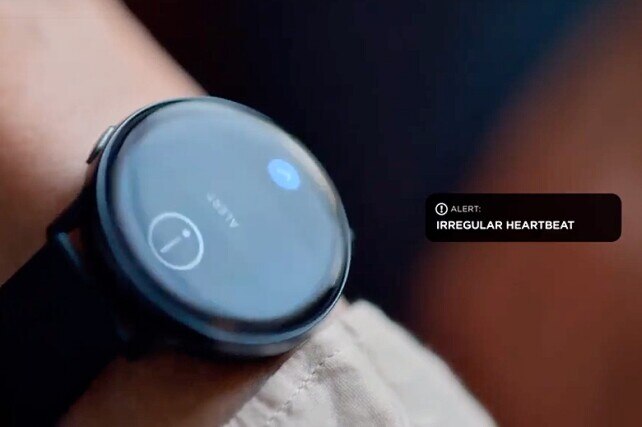 Person's wrist with watch showing an irregular heartbeat alert