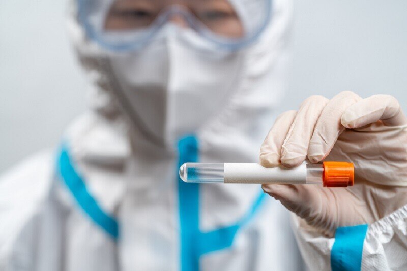 Vers un modèle de service de pathologie clinique post-pandémique