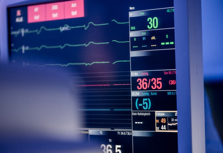 heart monitor
