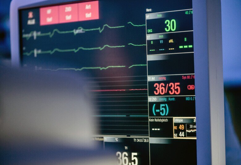 Medical monitor showing patient vitals